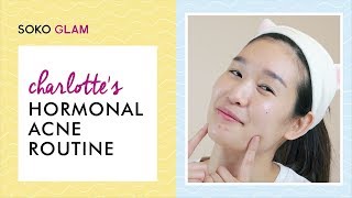 Charlotte's Hormonal Acne Routine