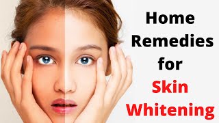 Home Remedies for Whitening Skin @glownaturally5271 Top 5 Tips for Face Whitening