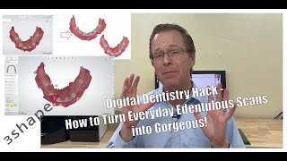 Digital Dentistry Secret Hack - How to Turn Everyday Edentulous Scans into Gorgeous!