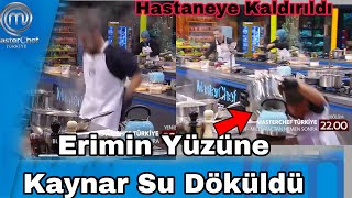 Masterchef Erimin Yüzüne Kaynar Su Döküldü Hastaneye Kaldırıldı Durumu Ciddi 16.11.24