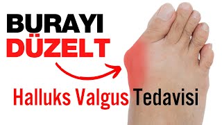 Ayak Başparmak Kemik Çıkıntısı Nasıl Düzeltilir ? Halluks Valgus Ateli TECH LOVE Bunion Corrector