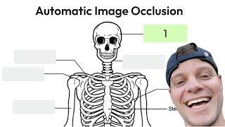 How to Do Automatic AI Image Occlusion in Wisdolia + Export to Anki