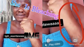 Asantewaa Is Bleaching Her Beautiful  Black Skin, Check this video out,