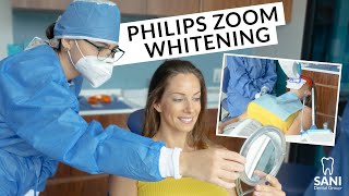 Zoom Whitening Before and After  | Cancun Dental Clinic