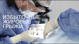 Мужская блефаропластика