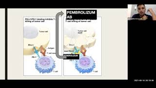 Adjuvant Pembrolizumab after Nephrectomy in RCC (NEJM Aug 2021) -  João Guilherme (R2 Urologia UERJ)