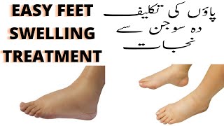 Feet Swelling Treatment |How to Reduce Foot Swelling in Urdu Hindi | Feet Swelling Healthcare Remedy