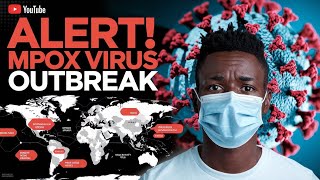 Monkeypox Virus Outbreak 2024: CDC Updates and Global Impact