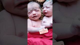 Adorable Twin Babies Lovely Moments After Birth