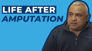 Life After Amputation | Sergio's Story