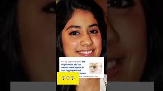 Janhvi Kapoor's Eyes plastic surgery #janvikapoor #youtube #shorts