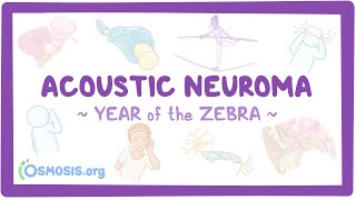 Acoustic neuroma (Year of the Zebra 2024)