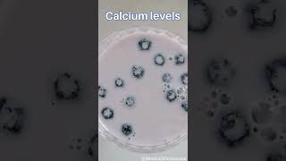 Calcium levels │ Selected medical terminology │ #medicalterminology #calciumlevels #short