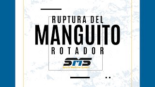 ¿Cómo se repara una lesión del "manguito rotador"?