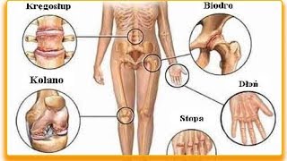 Bóle stawów? Pożegnaj je raz na zawsze!