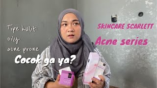 SETELAH PAKE SKINCARE SCARLETT ACNE | FACIAL WASH, ACNE SERUM, KRIM REVIEW