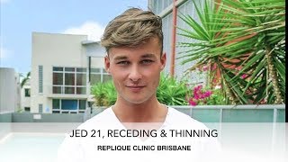 Jed's Talks About His First Men's Hair Piece Ph 0439 558 835