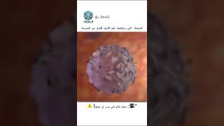 "🎥: مخاطر التاتو التي يجب أن تعرفها! ⚠️