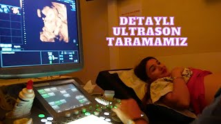 DETAYLI ULTRASONA GİRDİM🙏KIZIMIZIN SON DURUMU? MAHKEMEMİZ NE ZAMAN? Vlog