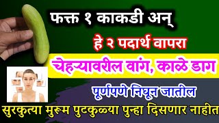 फक्त 1 काकडी| चेहऱ्यावरील वांग काळे डाग पूर्णपणे जातील, मुरूम, पुटकुळ्या गायब, vang upay, kale dag