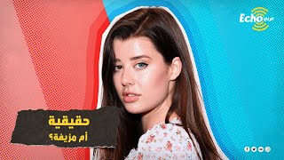 سارا ماكدانيال..  أجمل عارضة أزياء في العالم وصاحبة العيون المتغيرة.. ووالدها يكشف اللغز الصادم؟