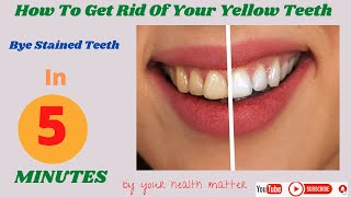 How To Whitens Yellow Teeth Naturally At Home {AMAZING RESULTS}