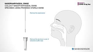 Инструкция SD BIOSENSOR STANDARD Q COVID-19 Ag, тест на антиген коронавируса в мазках из носоглотки
