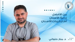 ما هو الافضل زراعة الاسنان ام تركيبات الاسنان؟