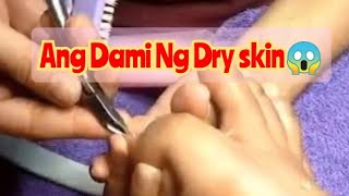 INGROWN AT DRY SKIN | ANG LALAKI ANG DAMING LAMAN 😱