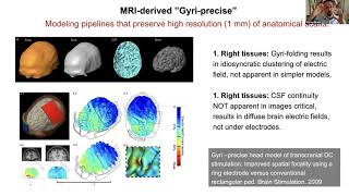 What makes good non-invasive brain stimulation models (tES, tDCS, tACS, TMS...)? Marom Bikson