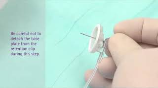 Surecan Safety II Port Access Needle Instructional Training Video