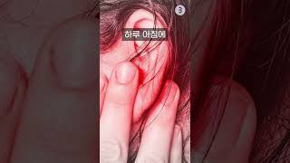 [500만] 갑자기… 귀가 들리지 않는다…? 반드시 알아두세요! (돌발성 난청 전조증상)