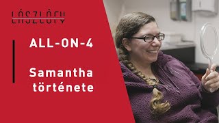 ALL-ON-4: Samantha története