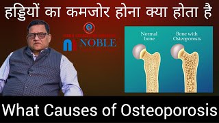 Osteoporosis क्या होता है? | Haddi ka Kamjor Hona | Osteoporosis in Hindi