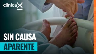 Inexplicable enfermedad afecta sus pies | Clínica X