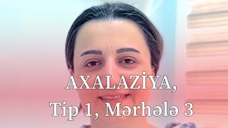 Qida borusu əmıliyyatı ,axalaziya Tip 1, Mərhələ 3 Mob:050 550 88 82