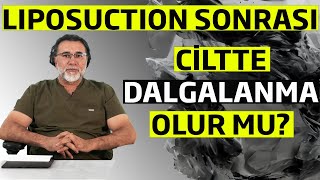 Liposuction Sonrası Ciltte Dalgalanma Olur mu ?