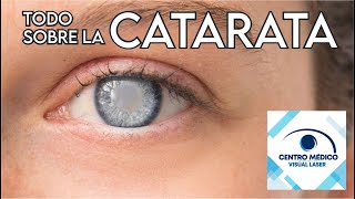 Conoce todo sobre la caratara. ¡Cuida tu visión!