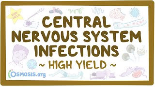 Central nervous system infections: Pathology review