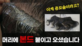 고객님이 머리에 본드를 붙이고 오셨어요.. 이게 증모술인가요?