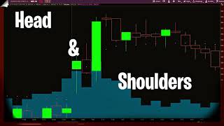 Head & Shoulders Example