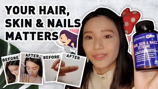 30-Days with Nano Singapore's Hair, Skin & Nails Extreme (ft. Nichole)