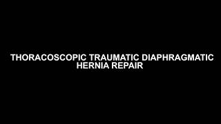 Thoracoscopic Diaphragmatic Hernia Repair-Dr. Atul Mishra