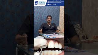 How To Fix Tooth Gap Quickly | Emax and Zirconia Crowns | Tamil