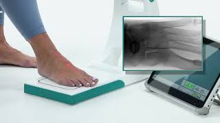 Smart-C Digital Motion X-ray for Podiatry | Point of Care Battery Powered Digital Imaging System