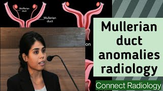 Mullerian duct anomalies radiology- PART- 2