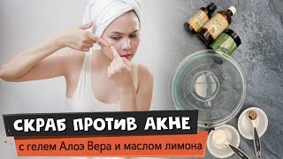 DIY косметика | Домашний скраб против акне | Алоэ Вера гель и масло лимона против прыщей | АРОМАТИКА