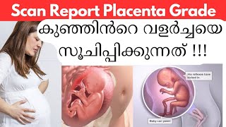 Scan Report Placenta Grade Postion കുഞ്ഞിൻ്റെ വളർച്ചയെ സൂചിപ്പിക്കുന്നത്/Placenta Position Malayalam