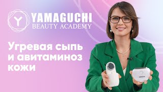 Какая связь между угревой сыпью и авитаминозом. Осенний уход за кожей и профилактика авитаминоза