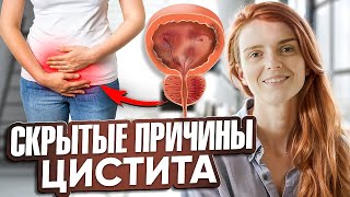 ЦИСТИТ Появляется Из-за ЭТОГО! Почему Мужчины и Женщины мучаются от Цистита?